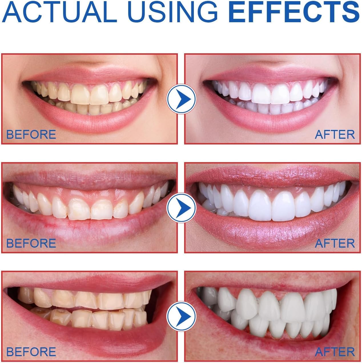 2PCS-SP-6 Whitening Toothpaste โ Enamel-Safe, Fluoride-Free, Fresh Mint