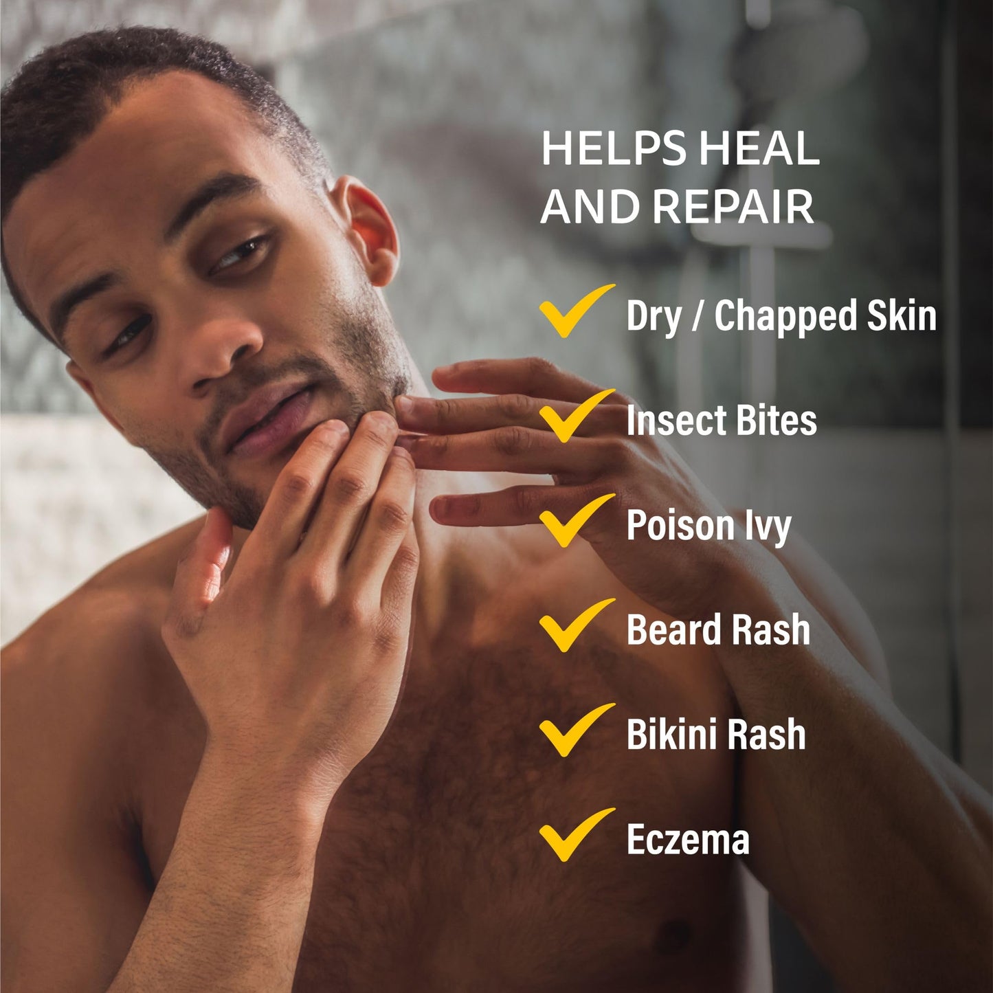 A+D Medicated Rash Ointment 15.2 oz β Soothes Poison Ivy, Eczema, Beard & Bikini Rash, Dry Skin
