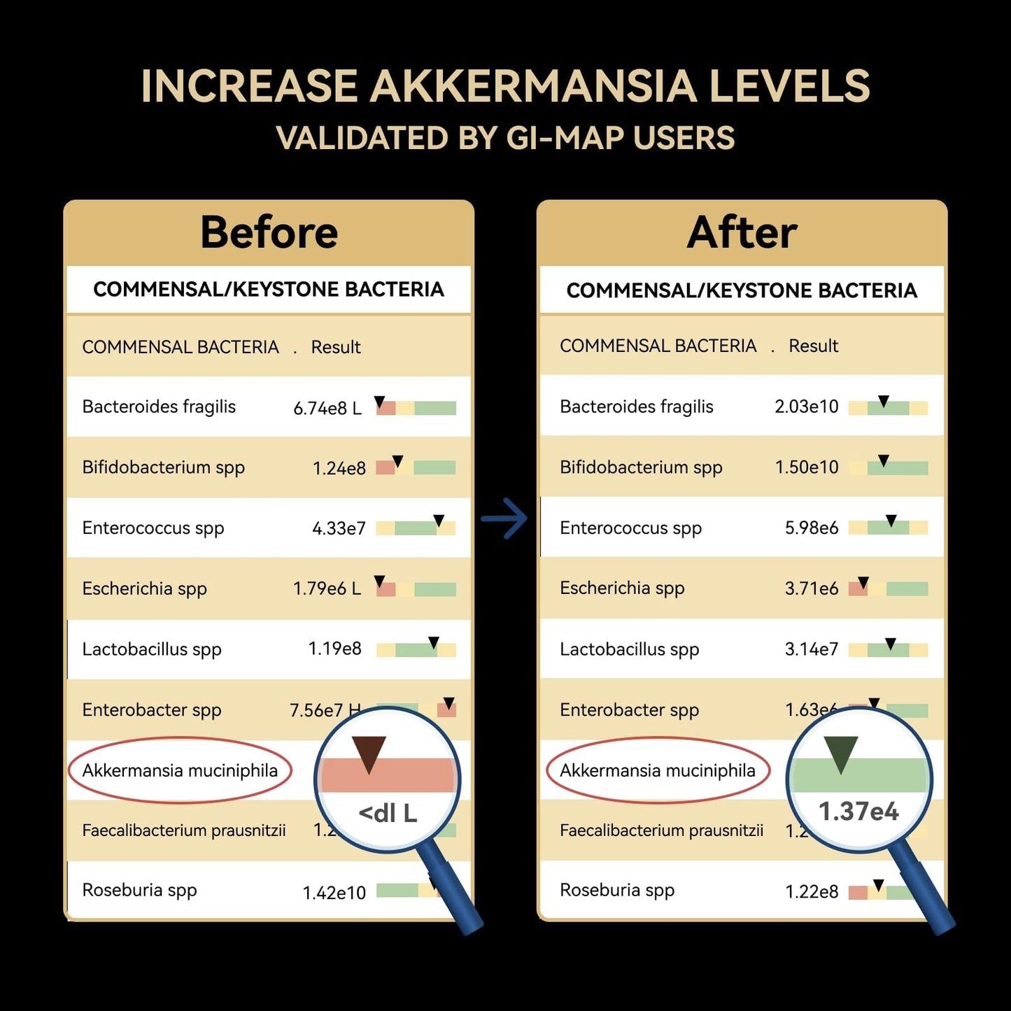 Akkermansia Probiotic โ 30B TFU, GLP-1 & Digestion Support