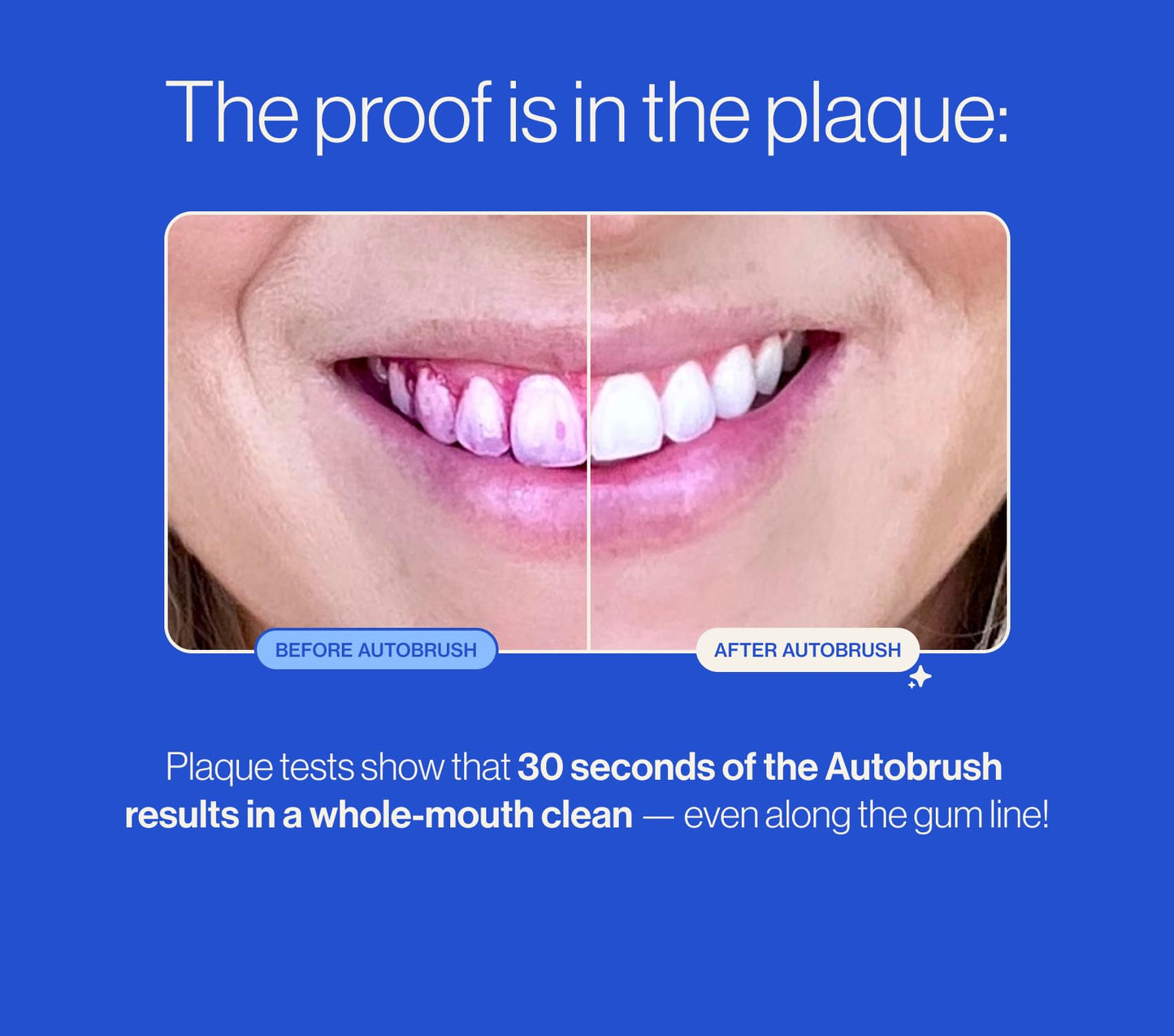 Autobrush Kids Electric Toothbrush โ ADA-Approved U-Shaped, 5.1x Cleaning, Ages 6-8 | Lion