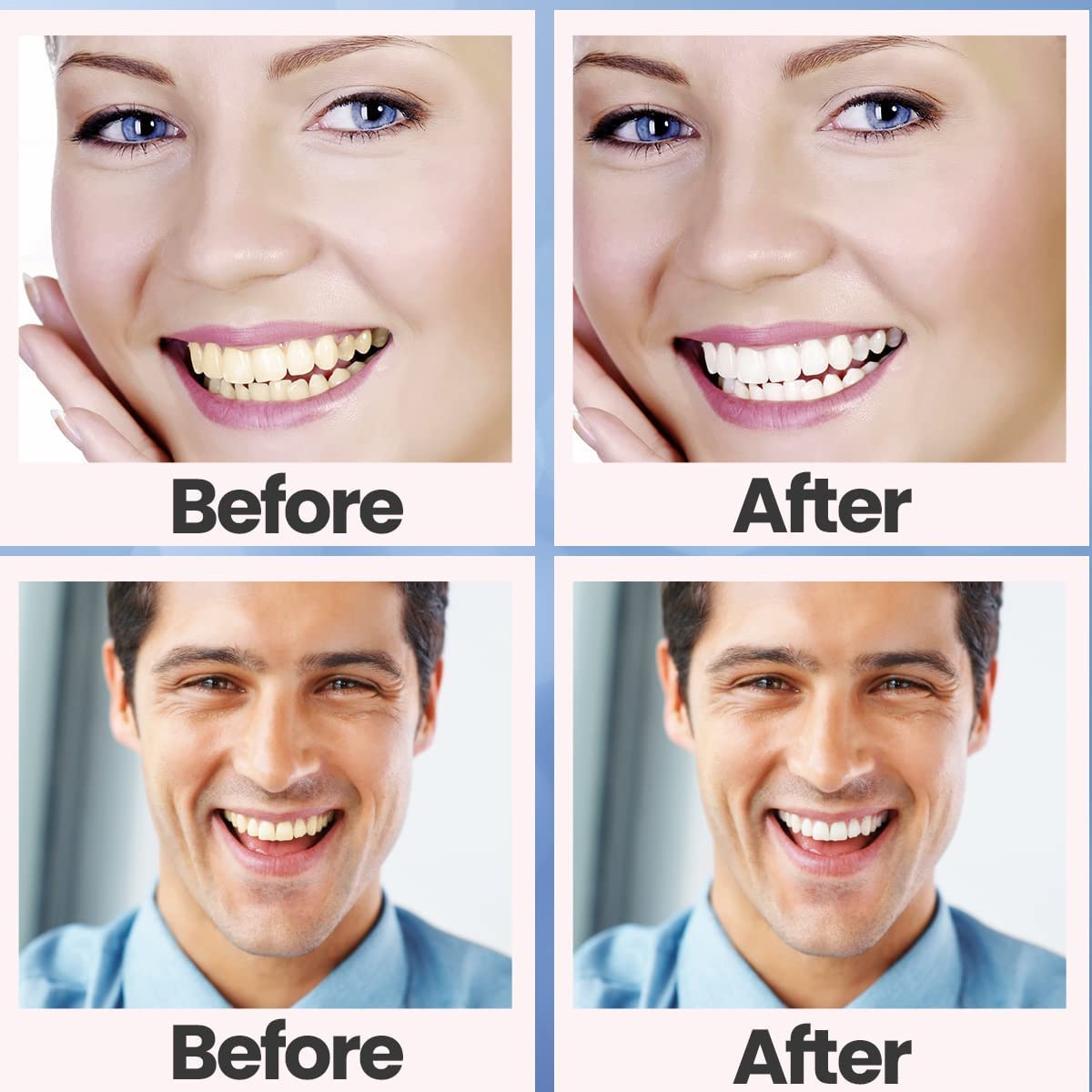 Teeth Whitening Strips โ 28 Pcs, 14 Treatments, Safe for Sensitive Teeth
