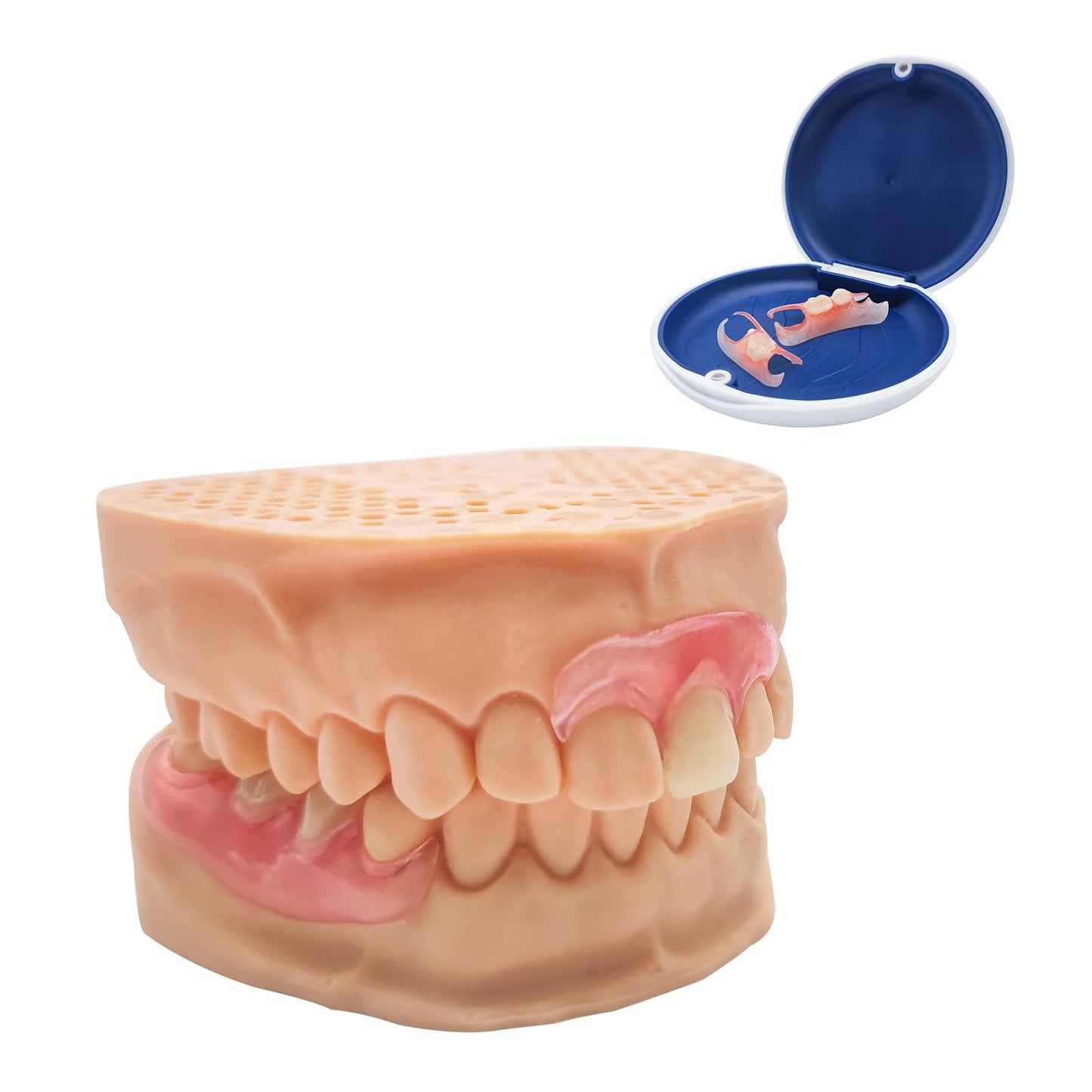 Custom Partial Dentures โ Removable Denture Set for Missing Teeth (1-6) with Case | Natural Look & Comfortable Fit