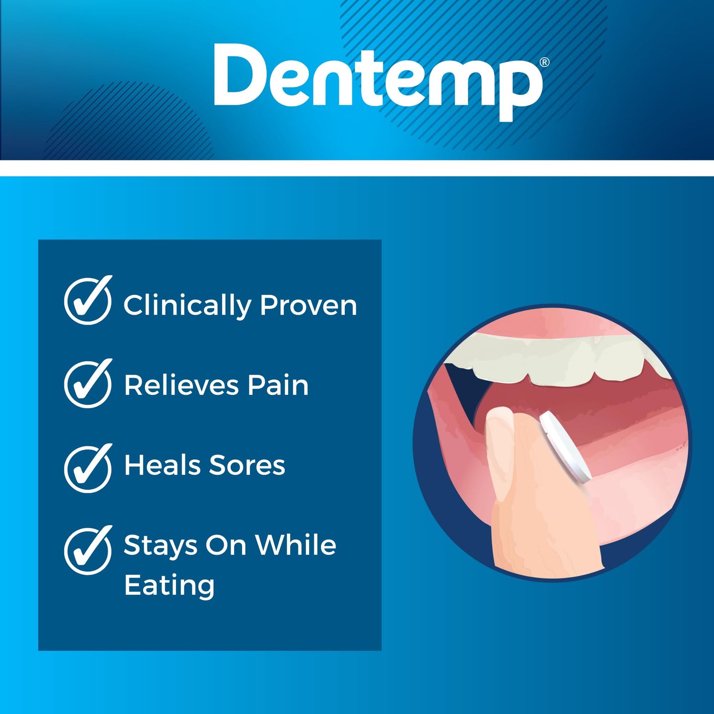 Dentemp Canker Cover โ Canker Sore Pain Relief Tablets (6 Count)