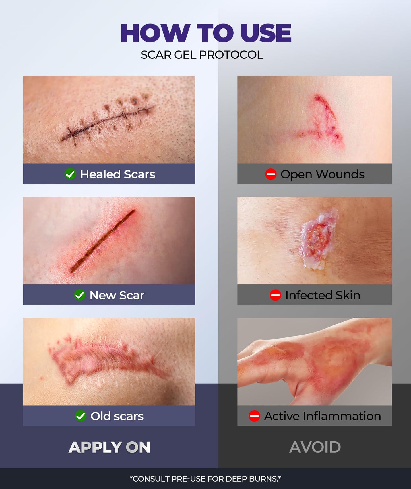 EASEWAVE Silicone Scar Cream with 6.7% Active โ Visible in 2 Weeks (55ml)
