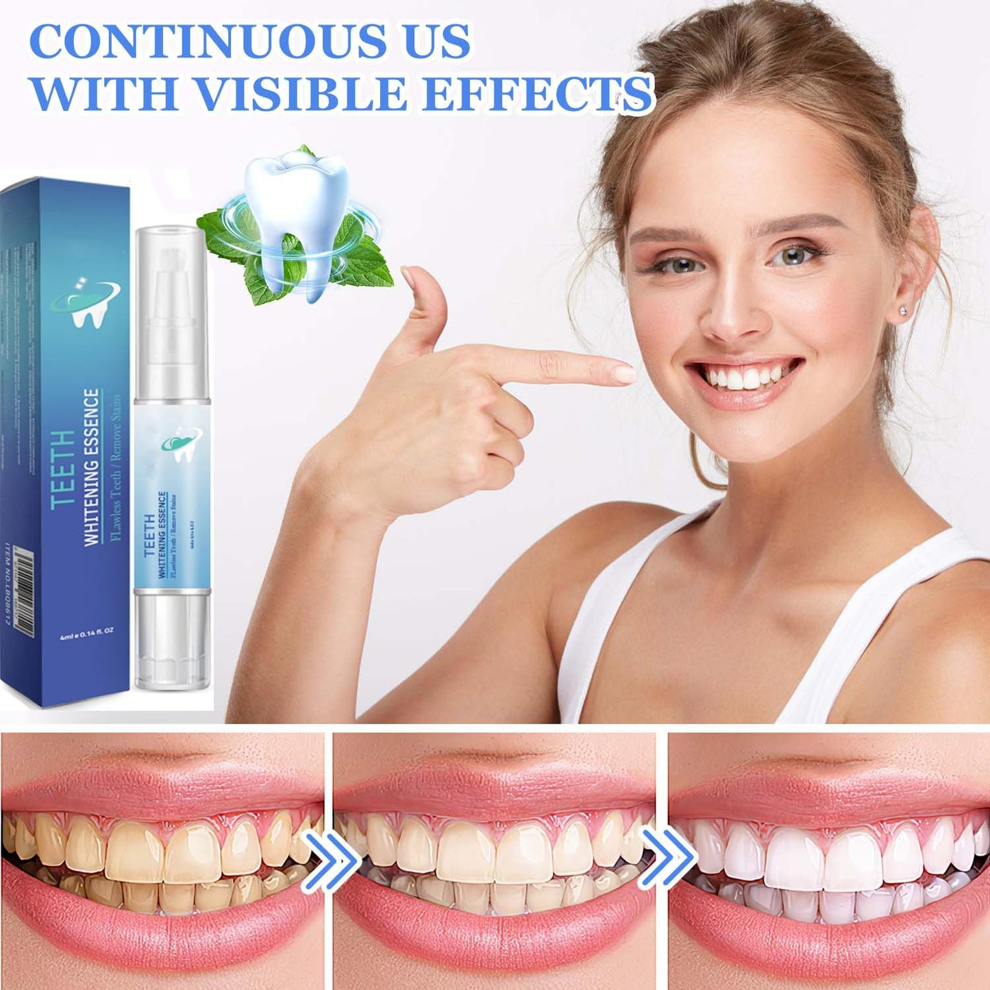 Frosty Neptune Teeth Whitening Pens & Essence (3Pcs) โ Fast Stain Removal