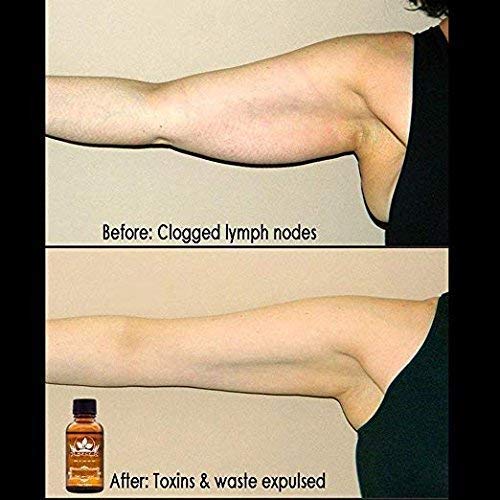 3 Pack Lymphatic Drainage Ginger Oil โ Ginger Massage Oil to Promote Blood Circulation, Suitable for Body Massage