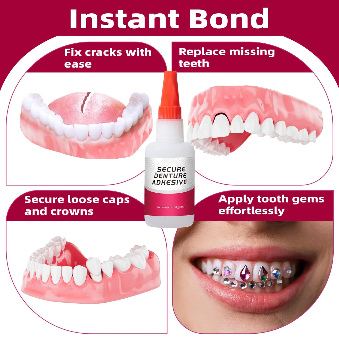 Dental Lab Instant Bonding Glue (1oz) for Denture Repair โ Quick Bond, Lasts Days to Weeks