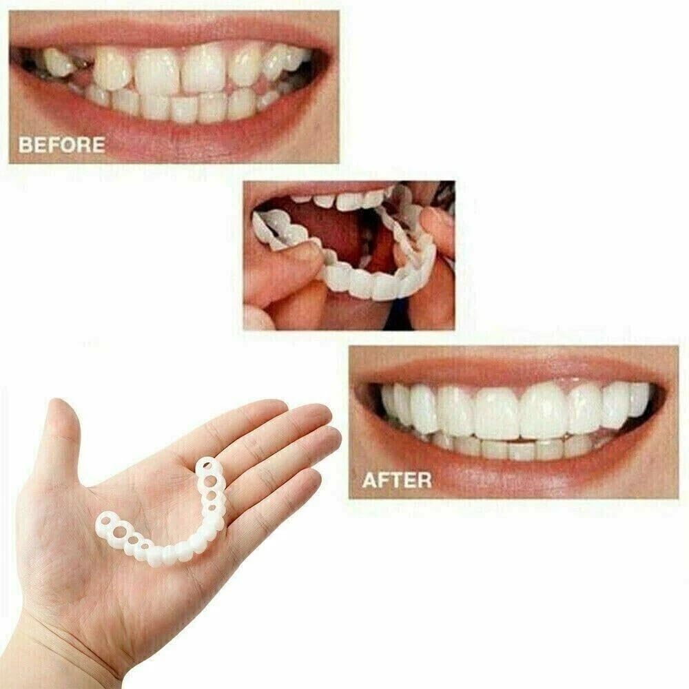 2 Pairs Natural-Looking Temporary Smile Solutions โ Top & Bottom Adjustable, Comfortable Experience