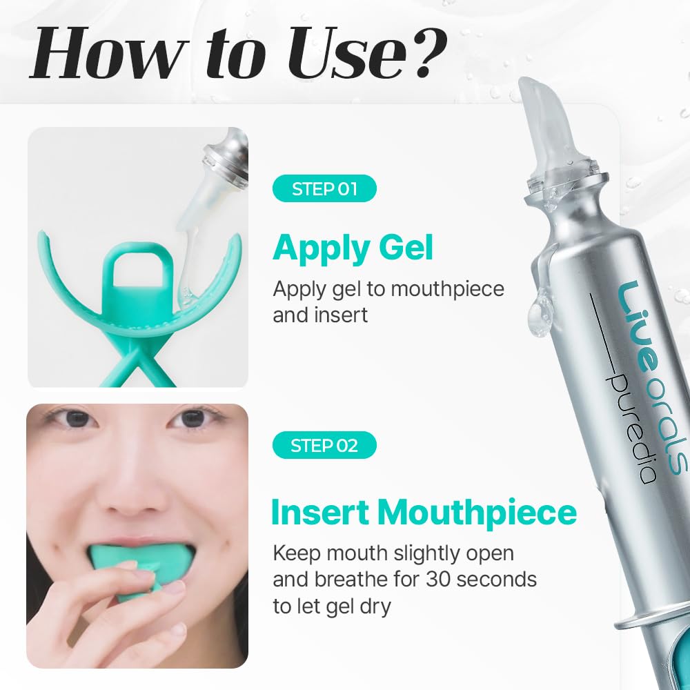 Live Orals PureDia Teeth Whitening Kit โ Gel & Mouthpiece (28 Treatments) | Dentist-Formulated for Sensitive Teeth