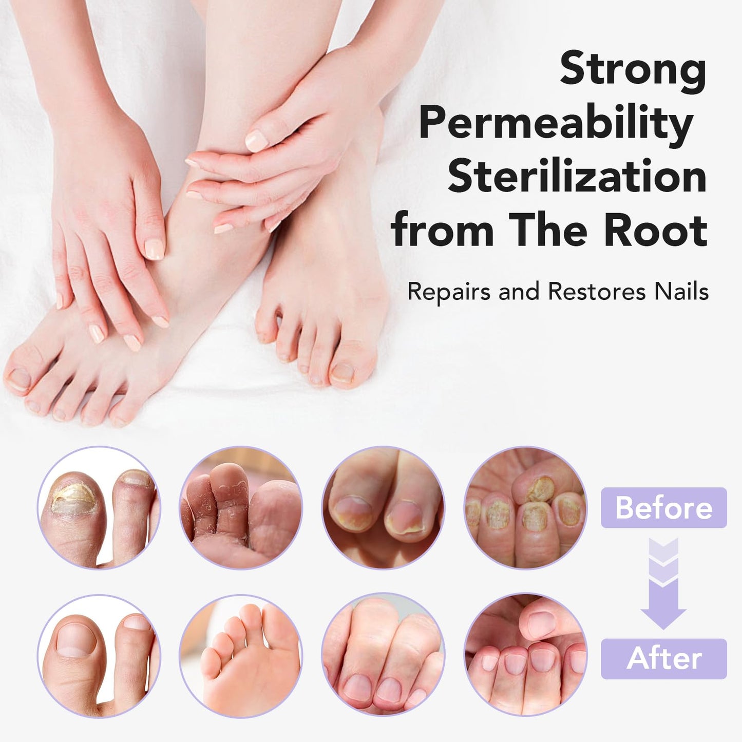 ourui one Toenail Fungus Treatment Extra Strength β Fast 4-Week Nail Care (30ml)