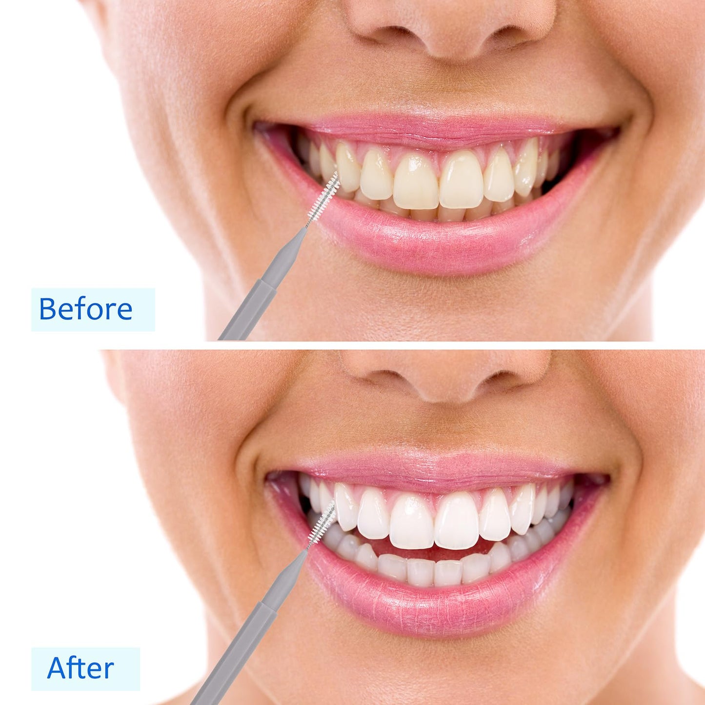 Patelai 100Pcs Braces Brush โ Interdental Toothpick & Flosser Set