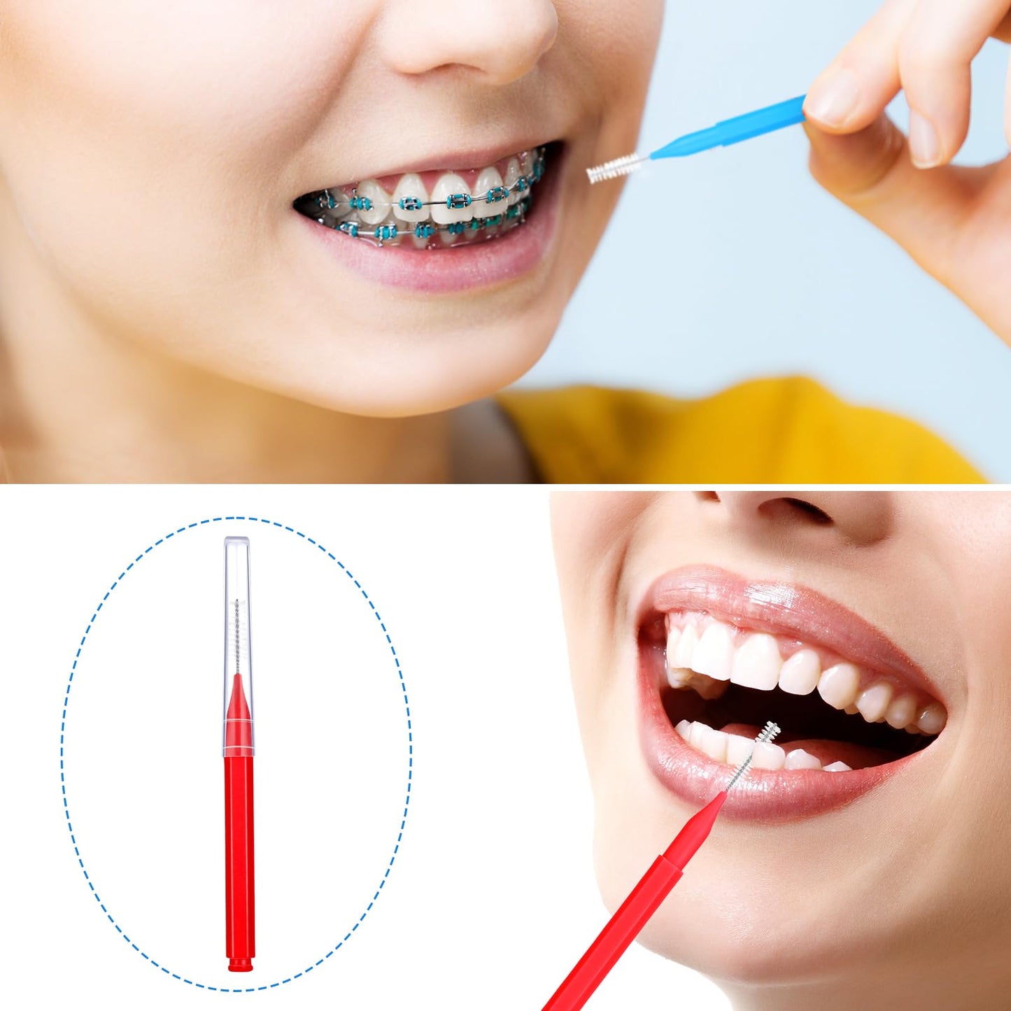 Patelai 100 Pieces Interdental Brushes โ Braces Brush for Cleaner Teeth (Blue, Red, Suitable Size)