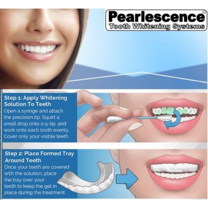 Pearlescence Teeth Whitening System 16% Carbamide Peroxide Gel Kit โ 2x10ml Mint Gel, 3 Boil and Bite Trays, Shade Guide