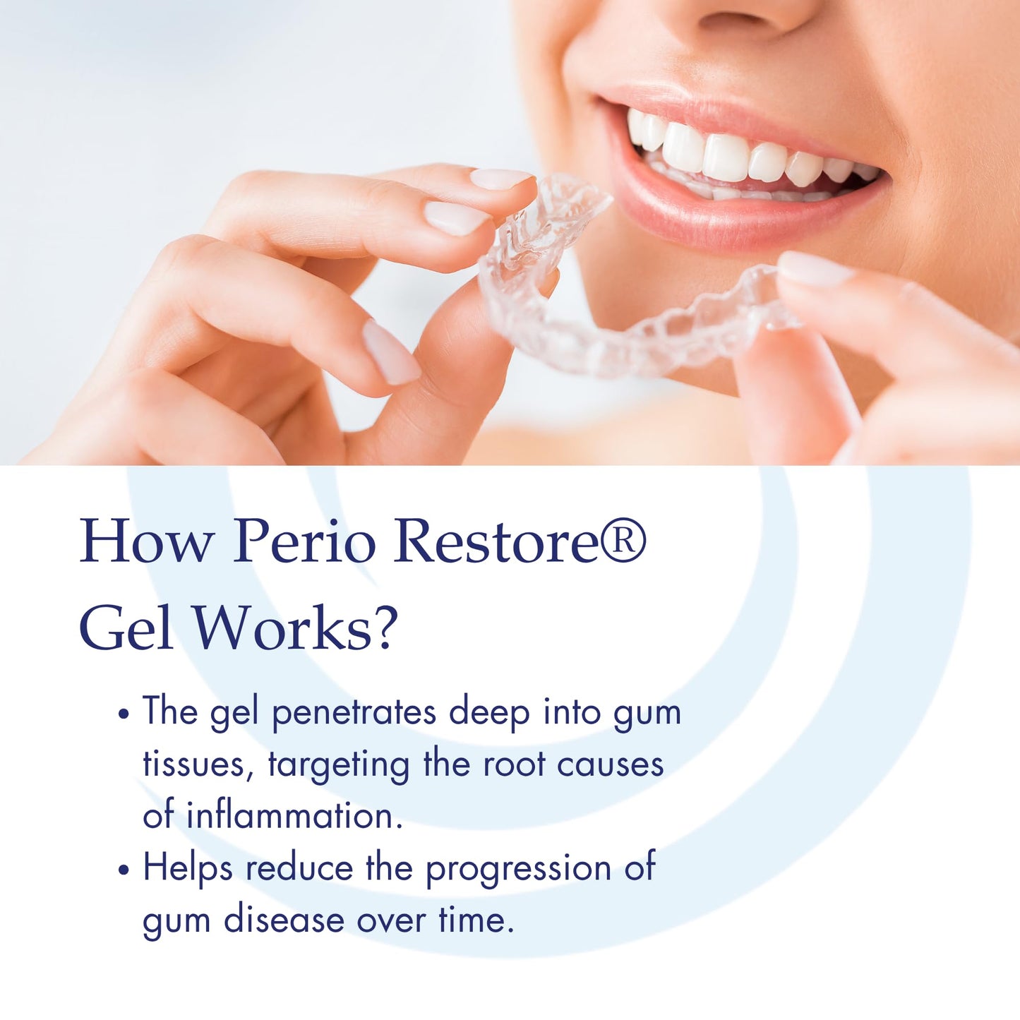 Perio Restore Gel 3 oz โ 1.7% Hydrogen Peroxide Oral Cleansing Gel, Mint