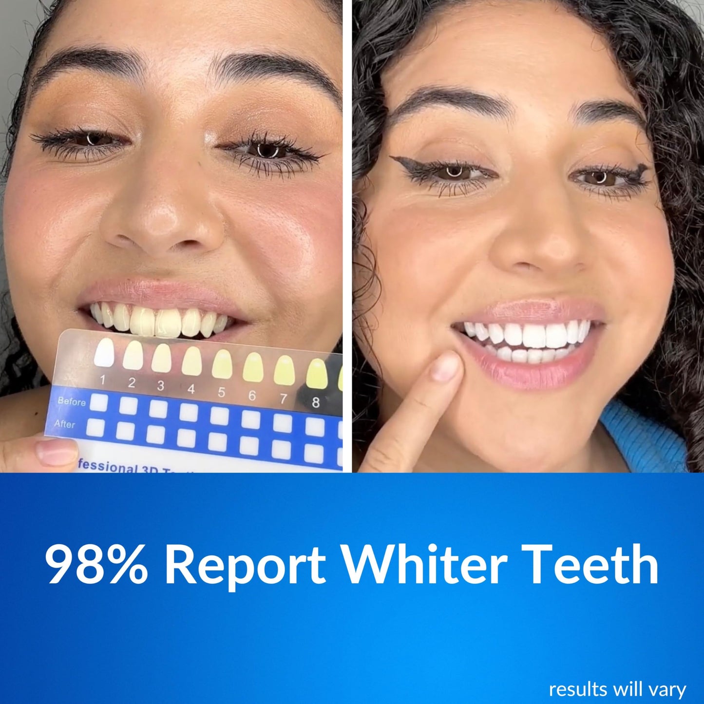 Polar MD Teeth Whitening Kit โ 1 Year Supply, 60 Treatments, Gel Pens, 32 LED Light