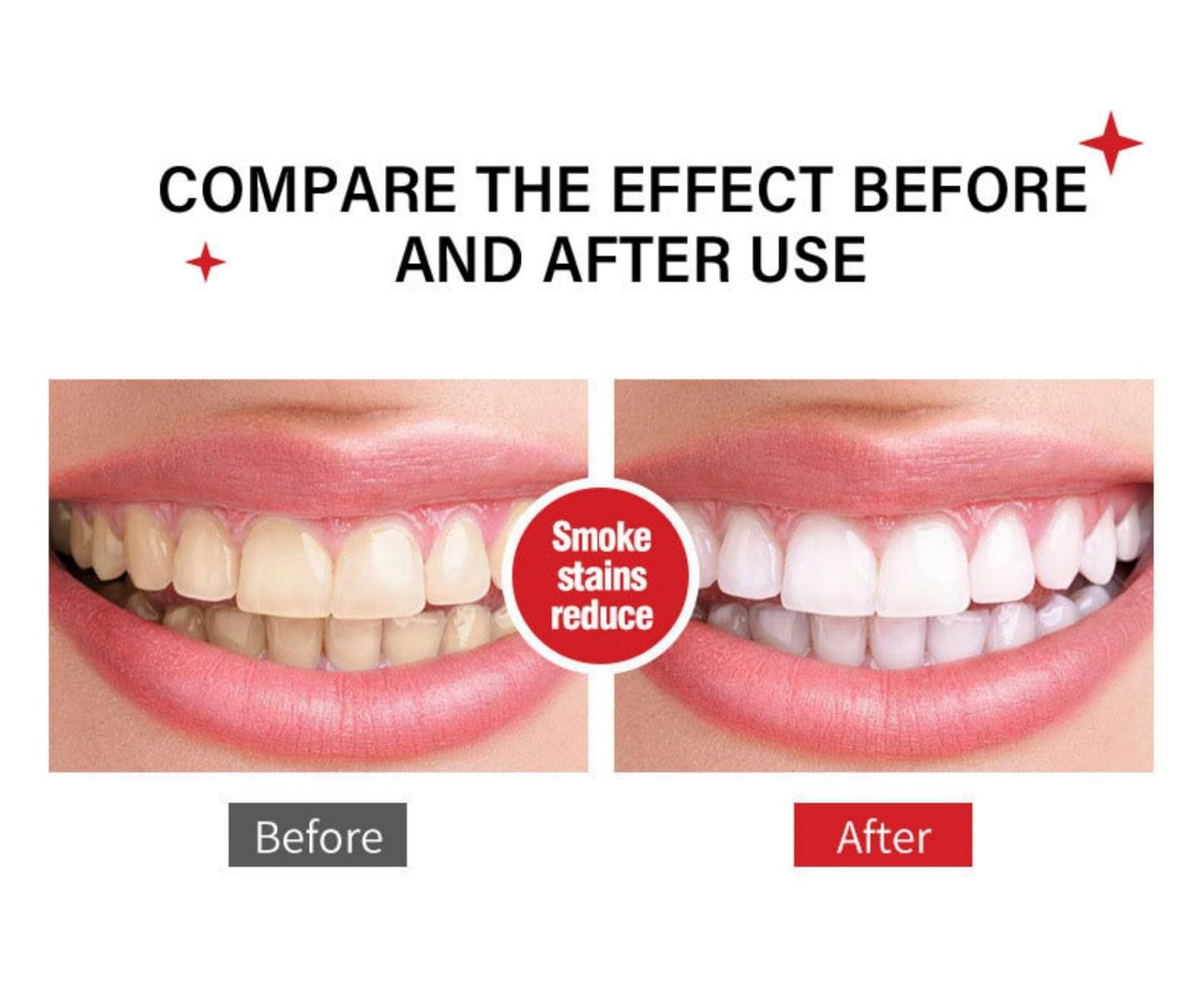 Sp-6 Ultra Whitening Toothpaste 2pcs โ Probiotics, Enamel-Safe, Fluoride-Free