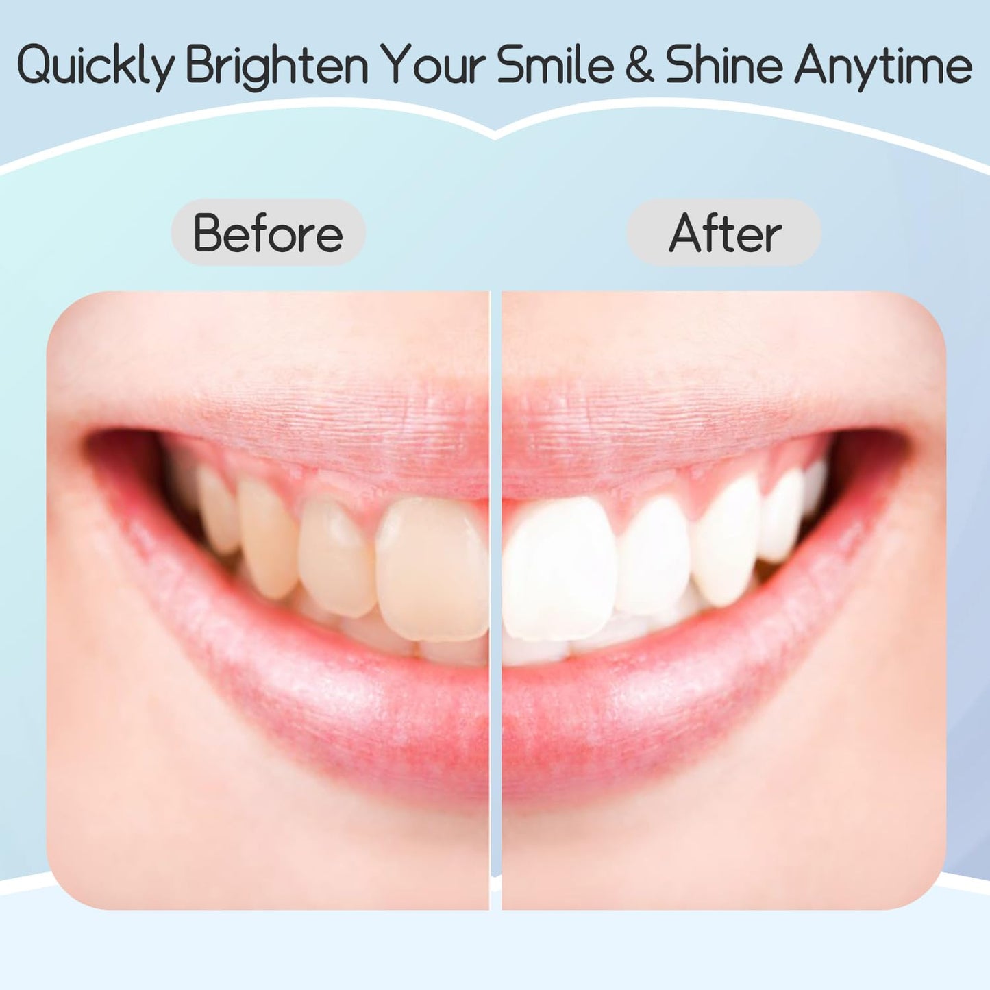 Teeth Whitening Strips โ Professional Effects, Safe & Gentle, 7-Day Stain Removal