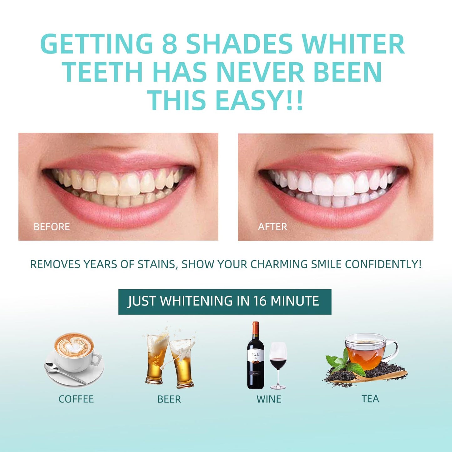 Teeth Whitening Kit with 32-LED Light โ At-Home Whitening System
