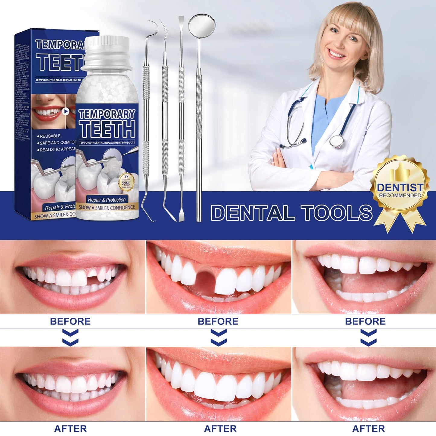 Tooth Repair Kit โ Moldable Tooth Filling & DIY Dental Restoration