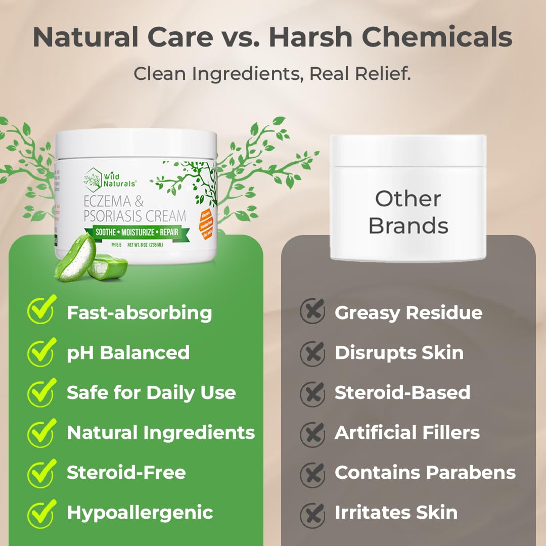Wild Naturals Eczema & Psoriasis Cream β Manuka Honey + Aloe, Hydrating Lotion for Dry Skin (Adults & Kids)