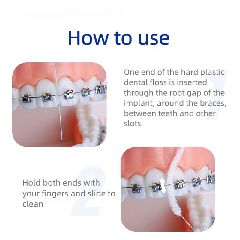 YANDY Dental Floss for Braces โ 200 Count, Threaders for Implants & Bridges