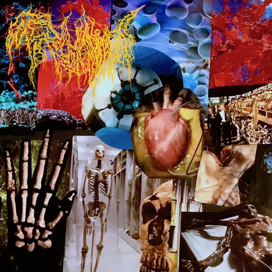 Trichomoniasis - Harvest of the Killing Fields CD