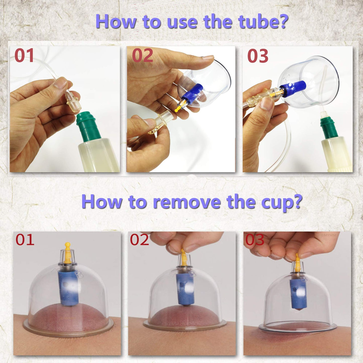 26 Cupping Cups Biomagnetic Traditional Chinese Therapy Kit | Household Vacuum Cupping Set