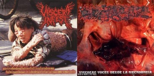 Viscera Infest / Paracoccidioidomicosisproctitissarcomucosis - Gastroduodenalulcerfollicularadenoma fulminanthepatitishydrocelefacialspasmyxomatosis / Viscosas voces desde la necroorgía
