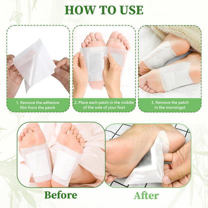 30PCS Bamboo Ginger Foot Pads – Deep Cleansing & Relaxation