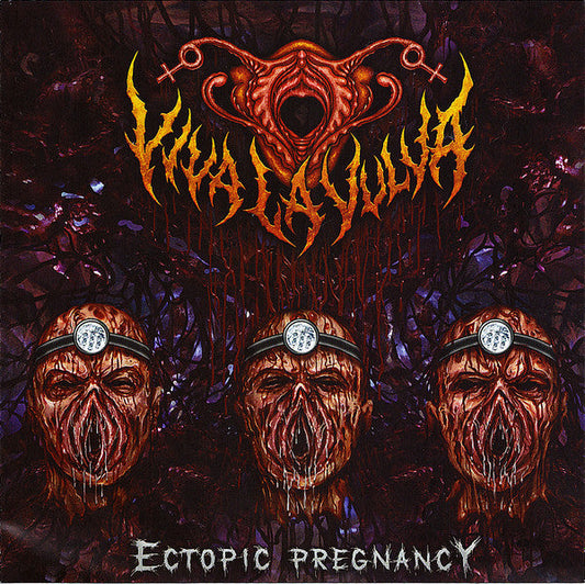 Viva La Vulva - Ectopic Pregnancy