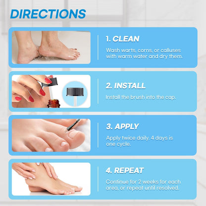 Aemerry Wart Corn Callus Remover – Maximum Strength Liquid Salicylic Acid for Feet (30ml)