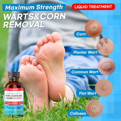 Aemerry Wart Corn Callus Remover – Maximum Strength Liquid Salicylic Acid for Feet (30ml)