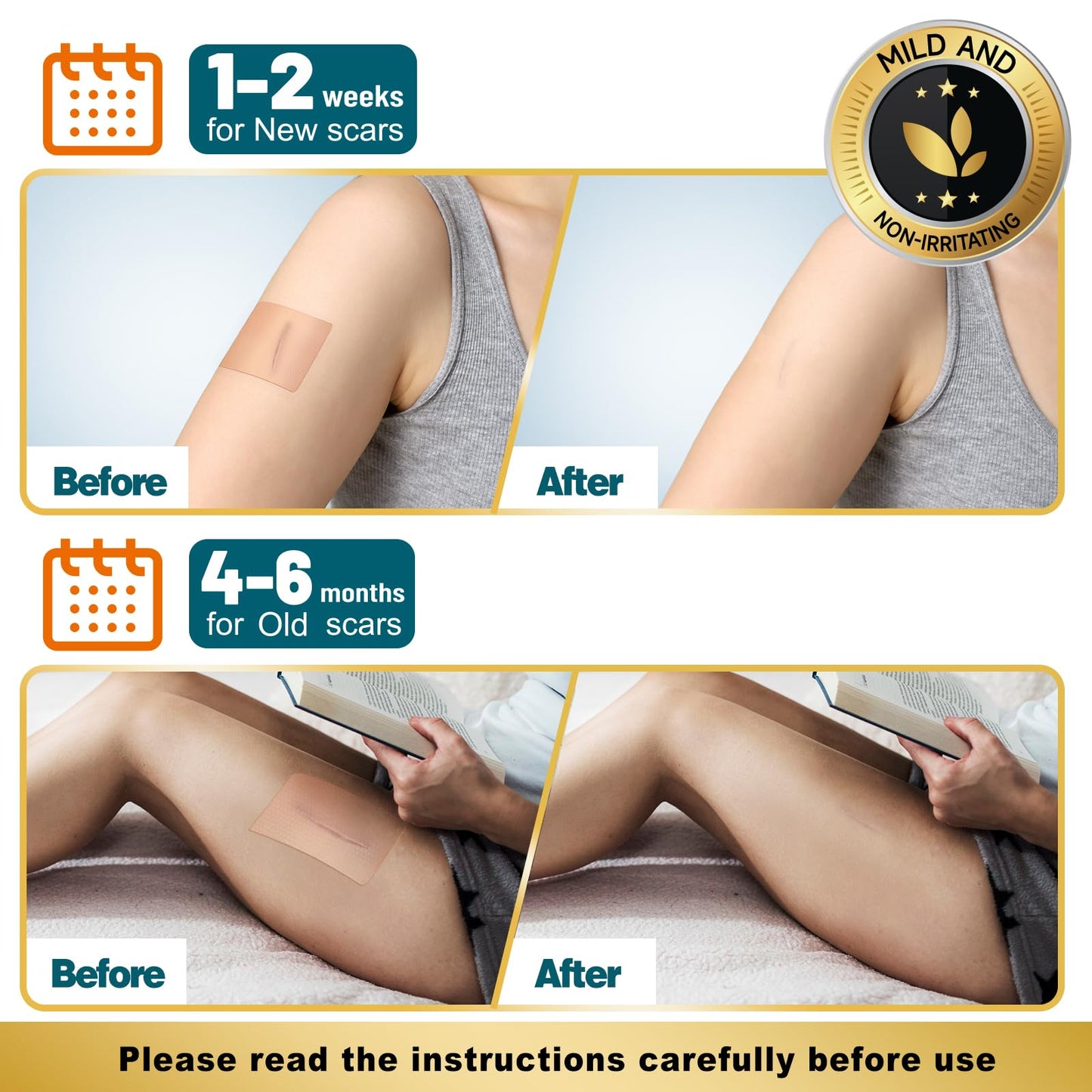 Arme Silicone Scar Tape Roll (1.6x180) – Medical-Grade Scar Sheets for Surgical Scars