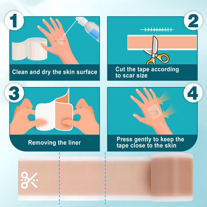 Arme Silicone Scar Tape – 1.6in x 240in Medical-Grade Scar Sheets (2 Rolls)
