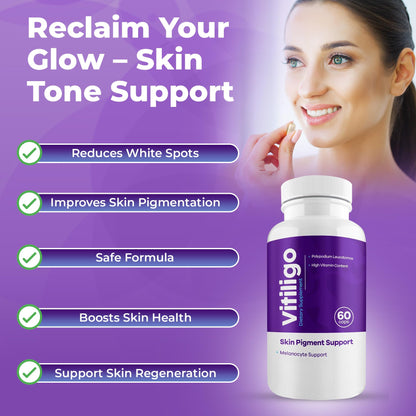 Aura Vitamins Vitiligo Capsules 60 Count | Support Skin Pigmentation & Reduce White Spots