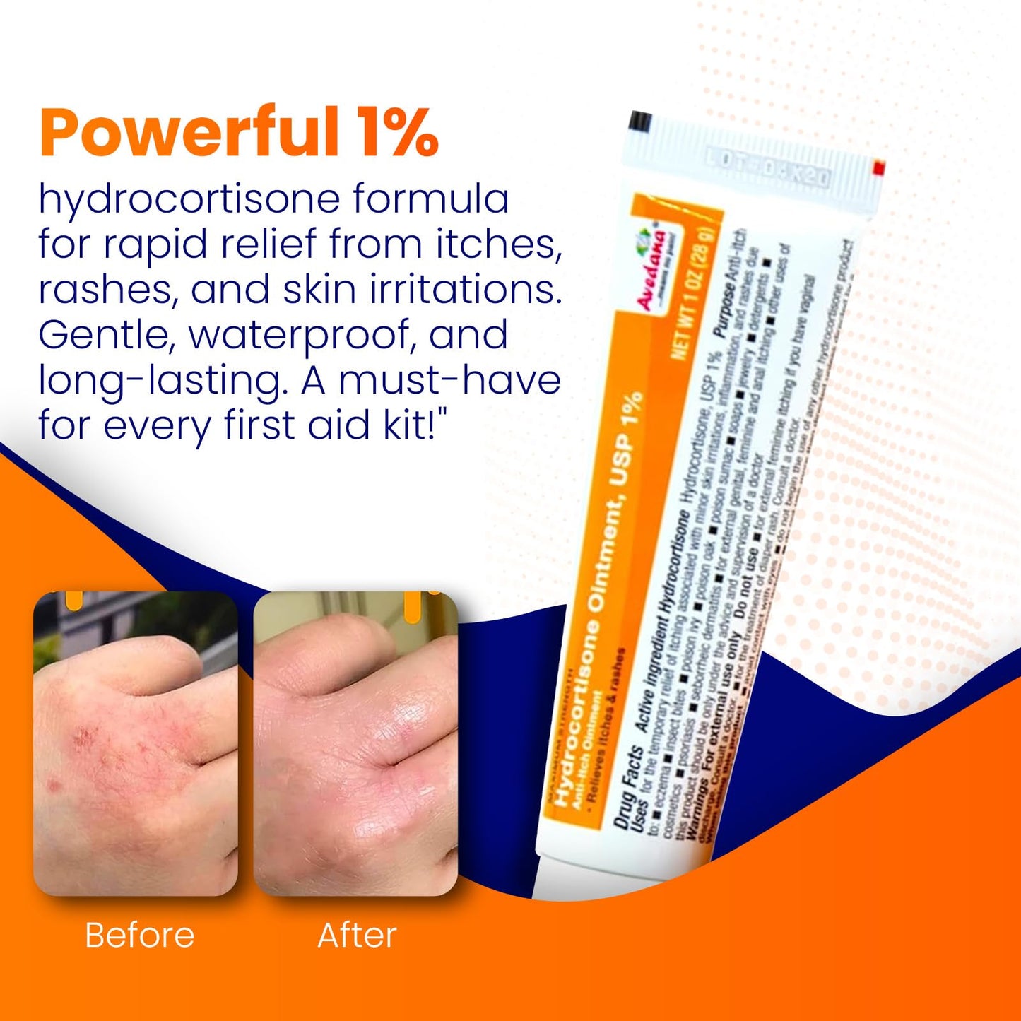 AVEDANA Hydrocortisone Ointment 1% – Maximum Strength, Waterproof Anti-Itch Relief