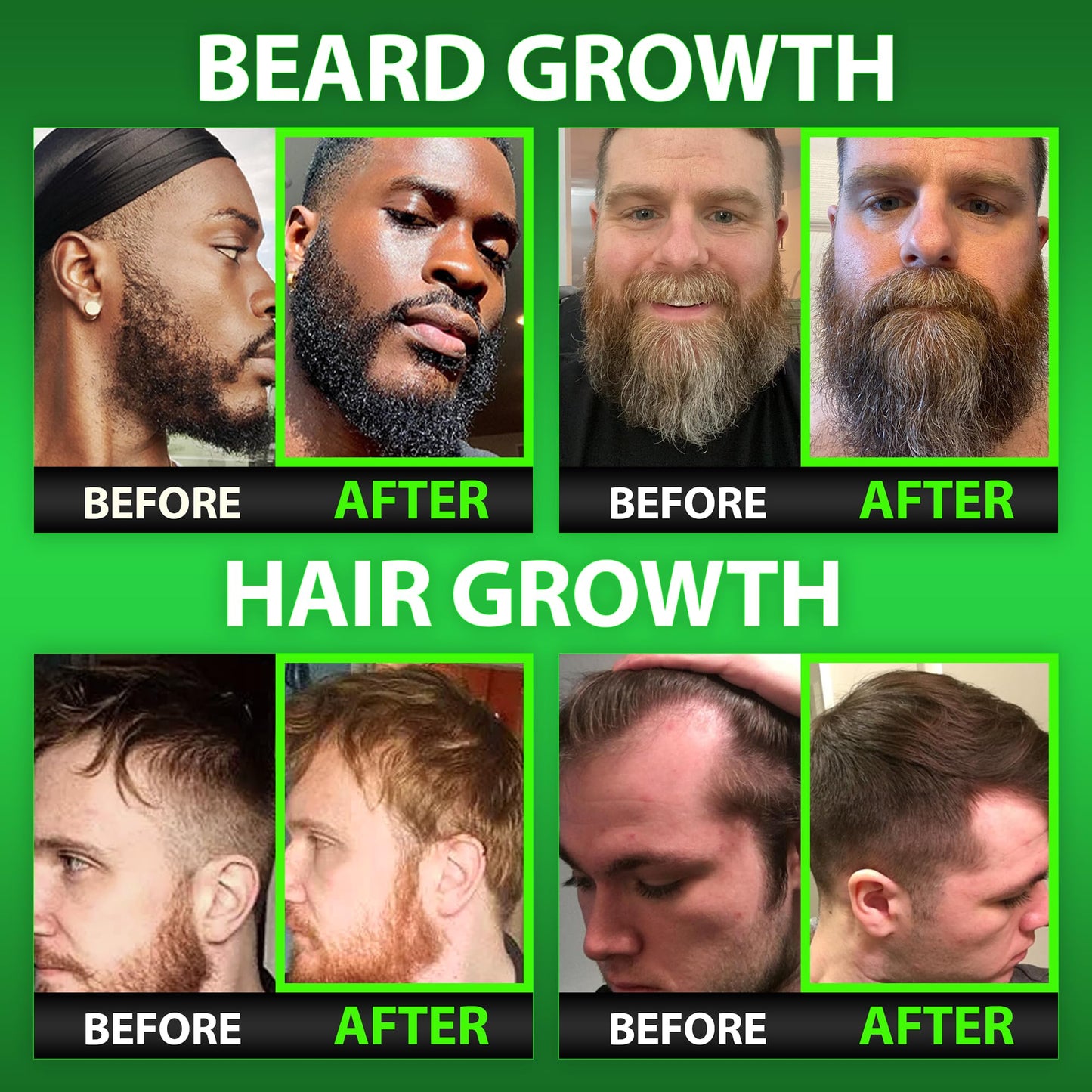 BBS Best Beard Stuff – Maximum Strength Biotin Gummies for Beard & Hair Growth