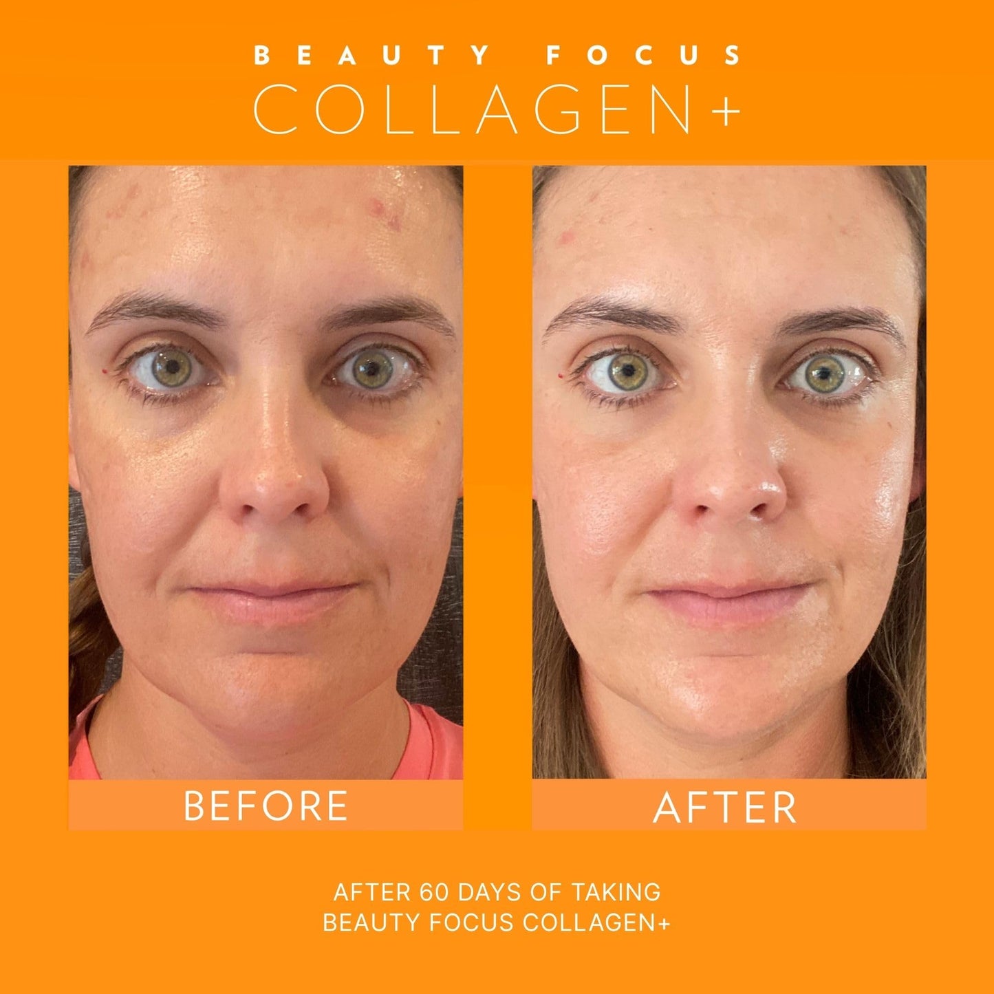 Beauty Focus Collagen Plus – Peach Flavor | 1.0 oz, 30 Packets | Skin Hydration & Hair Support