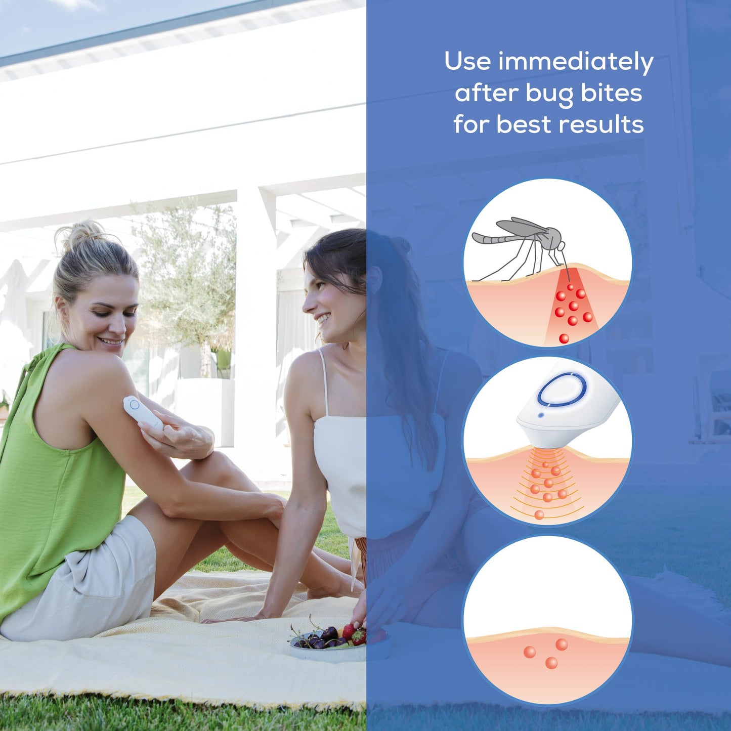 Beurer BR60 Insect Bite Healer – Chemical-Free Heat Relief