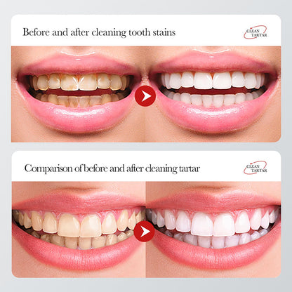 BIOAQUA 1.5X Instant Whitening Toothpaste – Balance Oral Flora, Fresh Breath 100g