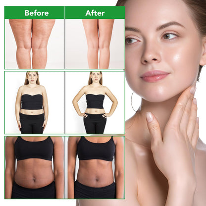 Body Oil Naturals Anti-Cellulite Massage Oil – Skin Tightening & Moisturizing (8.46 fl oz)