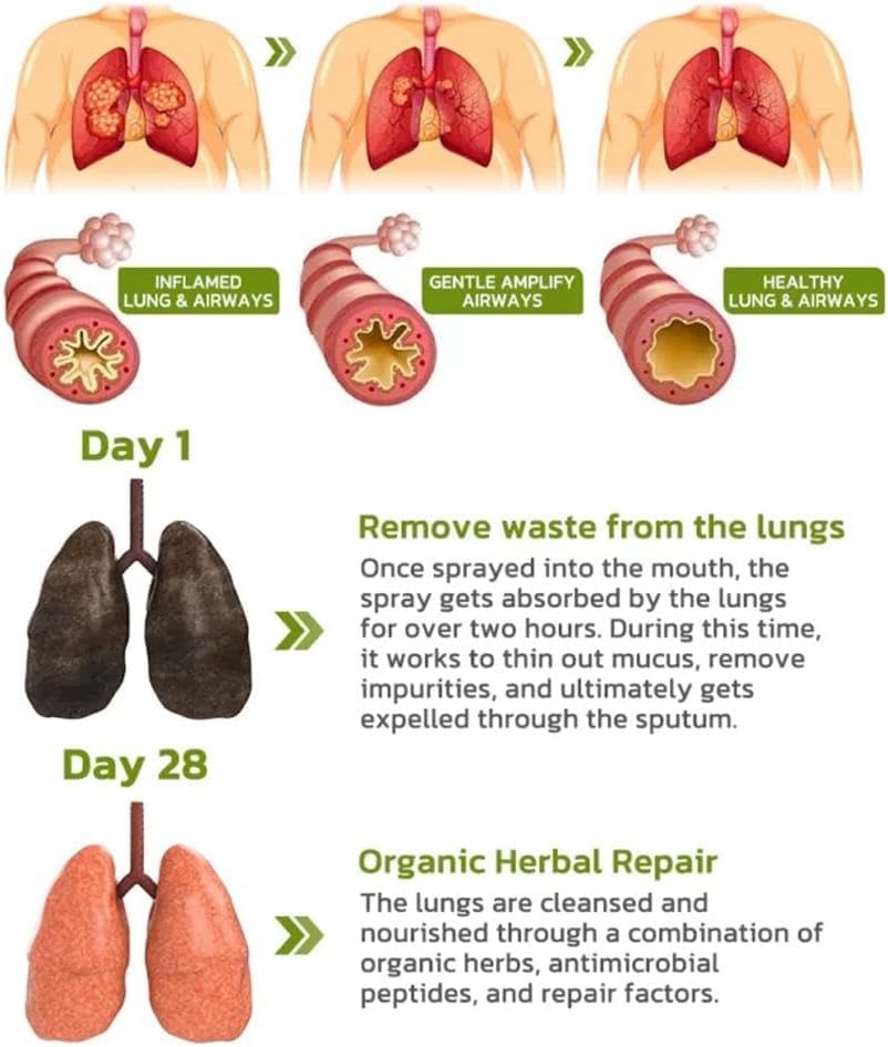 BreathDetox Herbal Lung Cleansing Spray - 3PCS | Natural Lung Support