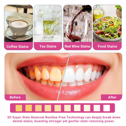 CALLSMILE Teeth Whitening Strips Kit – 16 Treatments (32 Strips) for Sensitive Teeth