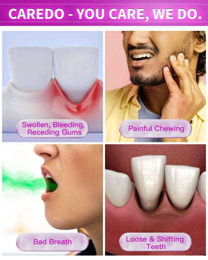 CAREDO Gum Repair Toothpaste - Fluoride Free Periodontal Treatment