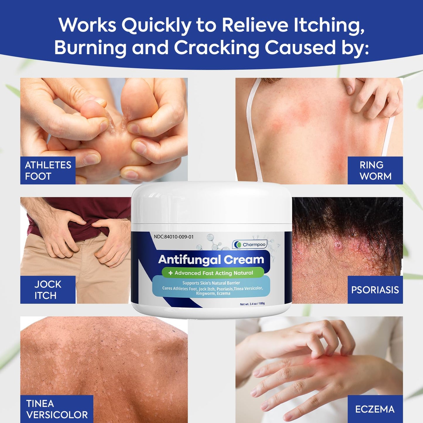 CHARMPOO Antifungal Cream for Itchy Skin Relief — Extra Strength Ringworm & Athlete's Foot Treatment (3.4 oz)
