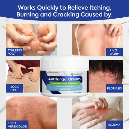 CHARMPOO Antifungal Cream for Itchy Skin Relief — Extra Strength Ringworm & Athlete's Foot Treatment (3.4 oz)