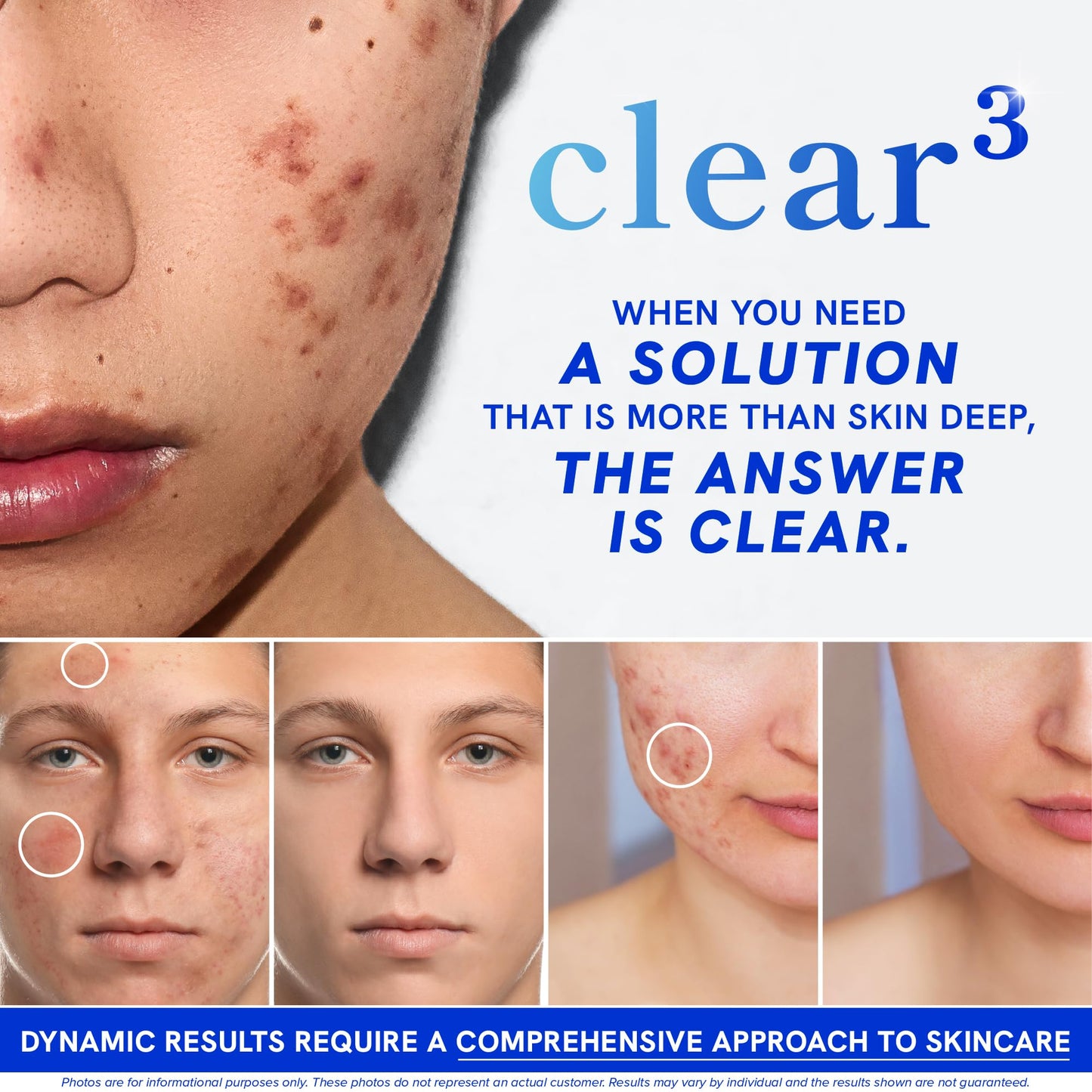 Clear Skin Supplement with Zinc, DIM & Probiotics | 60 Count