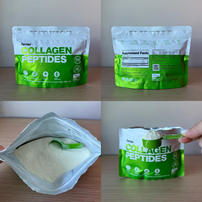 Hydrolyzed Collagen Peptides – Grass-Fed Type I & III, Unflavored, 28 Servings | Keto & Paleo