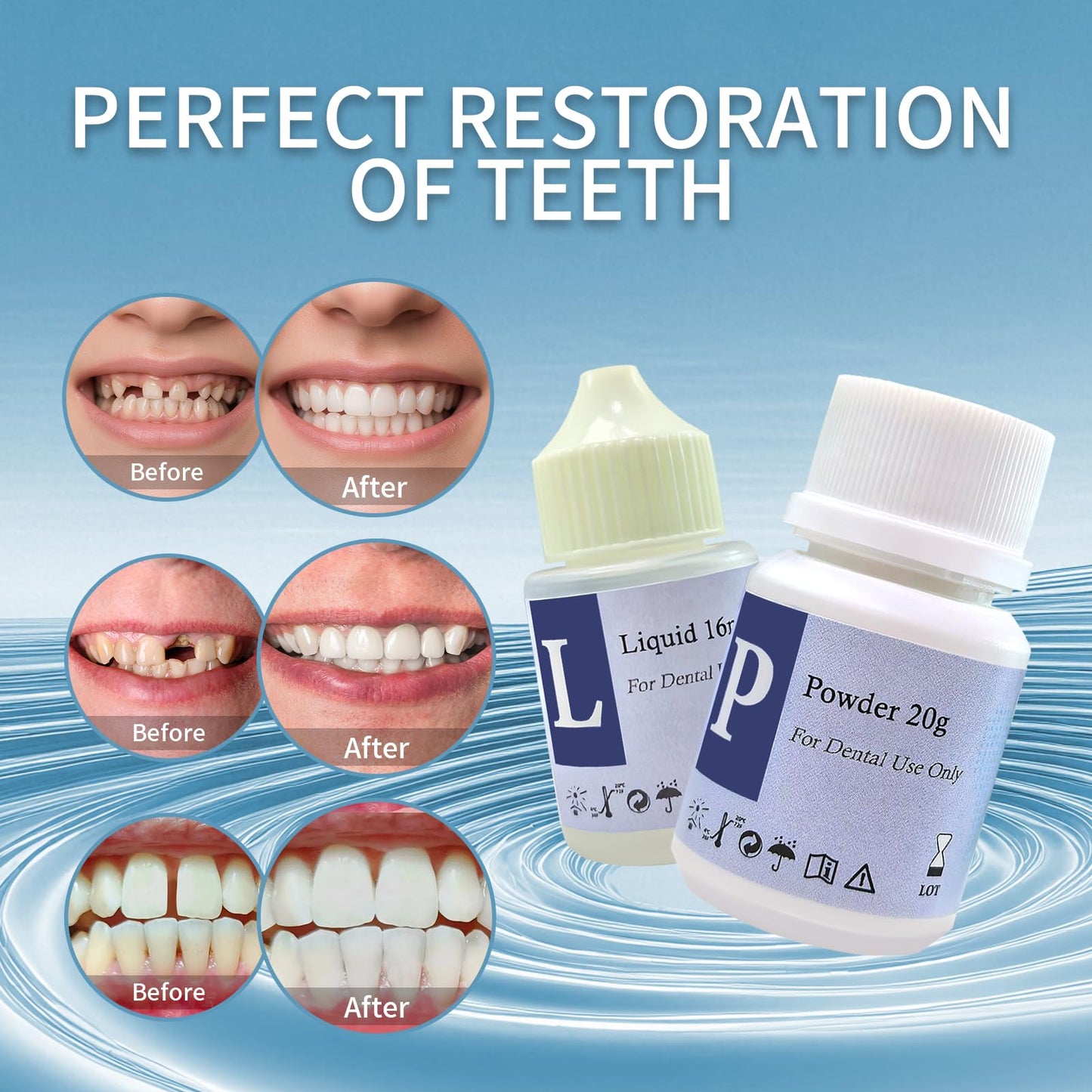 Zinc Oxide Eugenol Cement Dental Care Kit – Temporary Tooth Repair & DIY