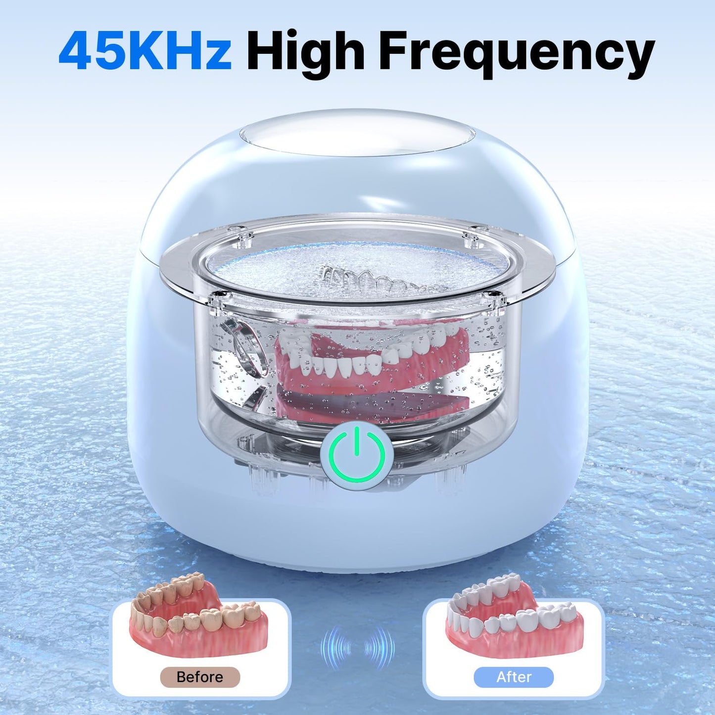 CXRUY Ultrasonic Retainer Cleaner – UV Dental Cleaning Pod for Dentures, Aligners & Night Guards